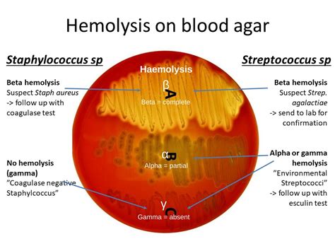 s aureus beta hemolytic|Staphylococcus Aureus Beta Hemolysis .